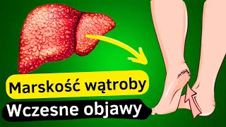 12 Pierwszych Objawów Uszkodzenia Wątroby  Przewodnik po Zdrowiu Wątroby [upl. by Kirschner]