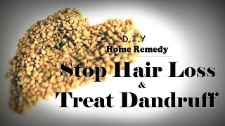 How To Stop Hair Loss and Treat Dandruff At Home Treatment and make hair grow long really fast [upl. by Rehpotsrik]