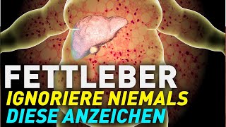 Fettleber Diese Symptome NIEMALS ignorieren [upl. by Ledua280]