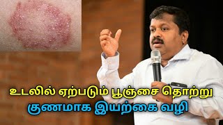 உடலில் ஏற்படும் பூஞ்சை தொற்று குணமாக இயற்கை வைத்தியம்DrSivaraman speech on fungal infection remedy [upl. by Lincoln]