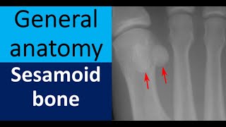 General anatomy Sesamoid bone [upl. by Haerb]