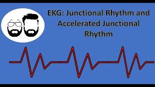 EKG Series Junctional Rhythm Accelerated Junctional Rhythm and Junctional Tachycardia [upl. by Atlas]