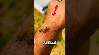 Voici comment survivre à une piqûre d’abeille 😨 [upl. by Barhos]