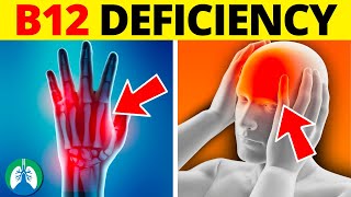 ⚠️ Top 10 Symptoms of Vitamin B12 Deficiency That You MUST Know [upl. by Teuton]