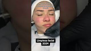 Limpieza facial profunda profesional  Paso a paso limpiezafacial [upl. by Talya]