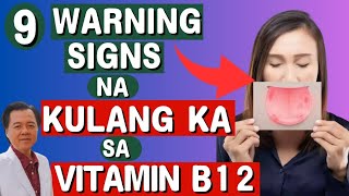 9 Warning Signs na Kulang Ka sa Vitamin B12  By Doc Willie Ong Internist and Cardiologist [upl. by Carny57]