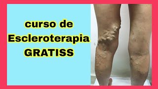 CURSO FLEBOTERAPIA MODULO 2 CURSO ESCLEROTERAPIA [upl. by Andaira]