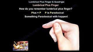 Lumbrical Plus Finger amp Quadrigia  Everything You Need To Know  Dr Nabil Ebraheim [upl. by Einaffyt]