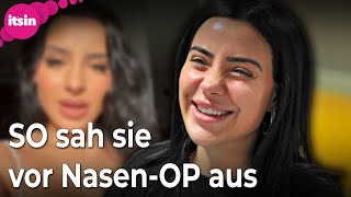 DschungelcampStar Leyla Lahouar So sah sie vor ihrer NasenOP aus • its in [upl. by Wichern]