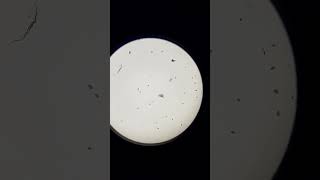 Microorganisms under microscope shorts [upl. by Irrok409]