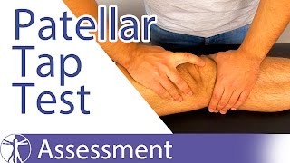 Patellar Tap Test  Ballottement Test⎟Knee Swelling [upl. by Myrtie837]