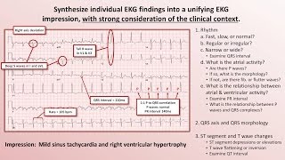 Intro to EKG Interpretation  The 5 Cardinal Rules [upl. by Ellicul263]