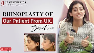 Results of Rhinoplasty  Patient from UK sharing review about rhinoplasty  Jj Aesthetics [upl. by Endaira68]