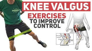 Knee Valgus  Rehab Exercises to Improve Movement Control [upl. by Acsicnarf]