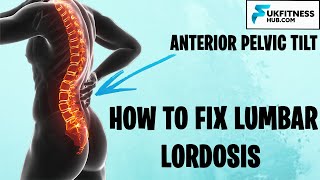 How To Fix Lumbar Lordosis and Anterior Pelvic Tilts  Full Exercise and Stretch Plan [upl. by Immaj]