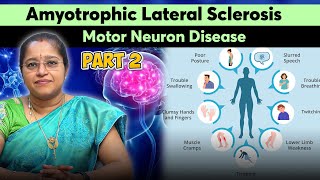 Amyotrophic Lateral Sclerosis  Motor Neuron Disease  Part 2  DR A VENI MD DM NEURO [upl. by Marsiella]