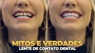 TUDO O QUE VOCE PRECISA SABER ANTES DE COLOCAR LENTES DE CONTATO DENTAL [upl. by Jaclyn]