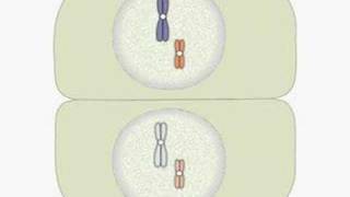 Trisomy [upl. by Cassandry]