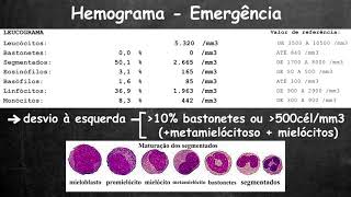 Shorts Ddímero para investigar dissecção de aorta [upl. by Leandra]