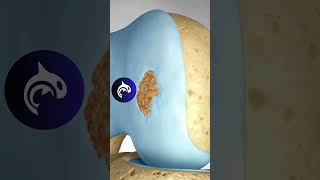 See how Damaged Knee Cartilage is restored in 3D Animation Osteochondral Autograft OAT [upl. by Roseann192]