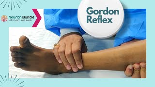 Gordons Reflex alternative to Babinskisign cns neurology extensorplantar medschool [upl. by Fenner924]