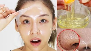 Egg White Face Mask  Diy Face Mask For Loose Skin Skin Tightening amp Open Pores 🌿 [upl. by Pauline]