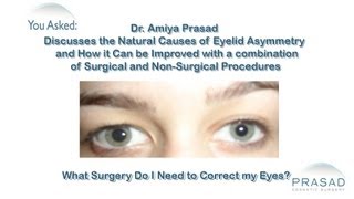 How Eyelid Asymmetry can be Addressed by Combining Surgical and NonSurgical Procedures [upl. by Aynav107]