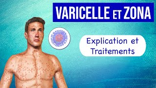 Varicelle et Zona  Explication et traitements [upl. by Omrellig595]