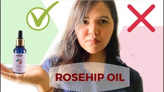 NYKAA ROSEHIP OIL  Benefits My experience Before and After Nykaa naturals essential oil range [upl. by Ahtar]