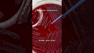 Moraxella catarrhalis Hocky Puck sign microbiology [upl. by Nolat]