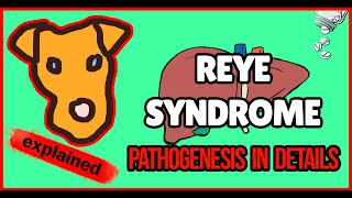 REYE SYNDROME in Children Mechanism of Liver injury Pathogenesis of Clinical symptoms [upl. by Mattland]