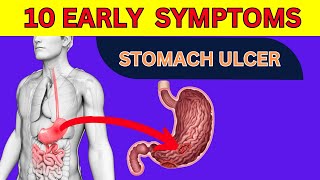 Top 10 Warning Signs of a Stomach Ulcer  Dont Ignore These GASTRIC ULCER SYMPTOMS [upl. by Spracklen77]