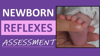 Newborn Reflexes Assessment Infant Nursing Pediatric NCLEX Review [upl. by Tomi280]