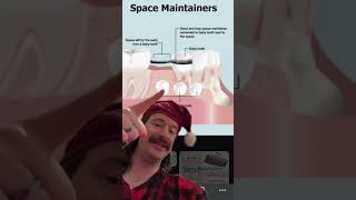 This is an orthodontic space maintainer [upl. by Novyaj]