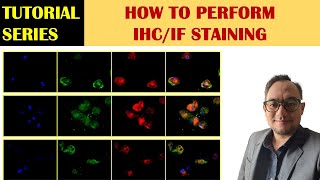 Immunofluorescence IF Staining Protocol for Adherent cells [upl. by Ogait]