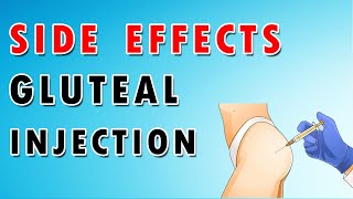 Injuries and Complications of Buttock Glute Injection [upl. by Cornew]