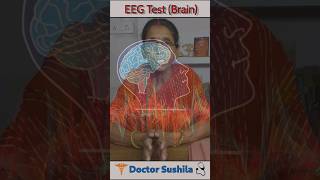 EEG Test for Brain 🧠 🧐  EEG Test kya hota hai  A simple explanation  shorts braintest [upl. by Ras65]