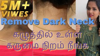 How to get rid of DARK NECKsimple and easy method100natural amp effectivetamil youtuber [upl. by Yddet]