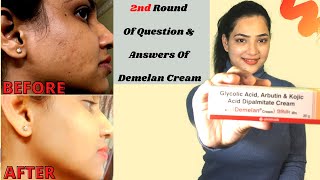 DEMELAN CREAM REVIEW  हिंदी में  My 1 Month Experience With Demelan Cream  Skin Lightening Cream [upl. by Rolyks]