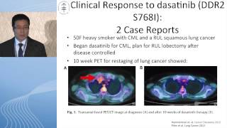 Squamous cell carcinoma Is there hope for targeted therapy [upl. by Ahsienar]