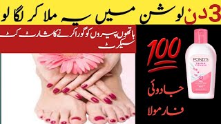 WINTER SKIN SAVIOR Hand and Fit Whitening Formula Cream Rakhi Home Tips [upl. by Yarazed]