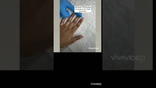 chemical peel for hands skincare beauty [upl. by Natie]