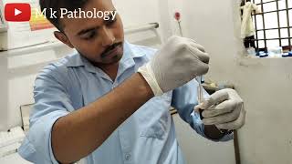 BLOOD CROSS MATCH  M K PATHOLOGY  Lab Technician Pathology  blood cross match tips [upl. by Scutt862]