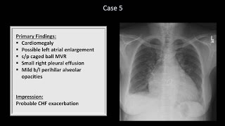 How to Interpret a Chest XRay Lesson 10  Self Assessment Part 1 [upl. by Doersten]