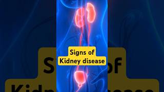 Signs of Kidney Disease Kidney disease health [upl. by Arella]