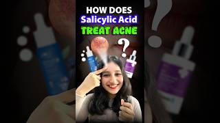 How does Salicylic acid treat acne acne salicylicacid serum csirnet neet biology sciencefact [upl. by Annais519]