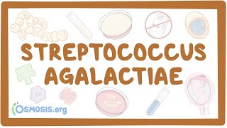 Streptococcus agalactiae group B strep  an Osmosis Preview [upl. by Addie]