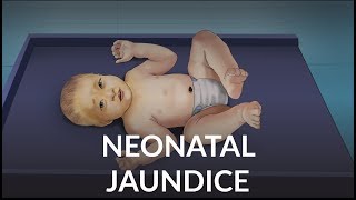 Neonatal Jaundice by L Veit  OPENPediatrics [upl. by Peisch]