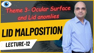 Lid Malpositions Lecture 12 [upl. by Caldeira]