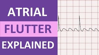 Atrial Flutter ECG Causes Treatment Nursing NCLEX ACLS Heart Rhythm Explained [upl. by Pascasia895]